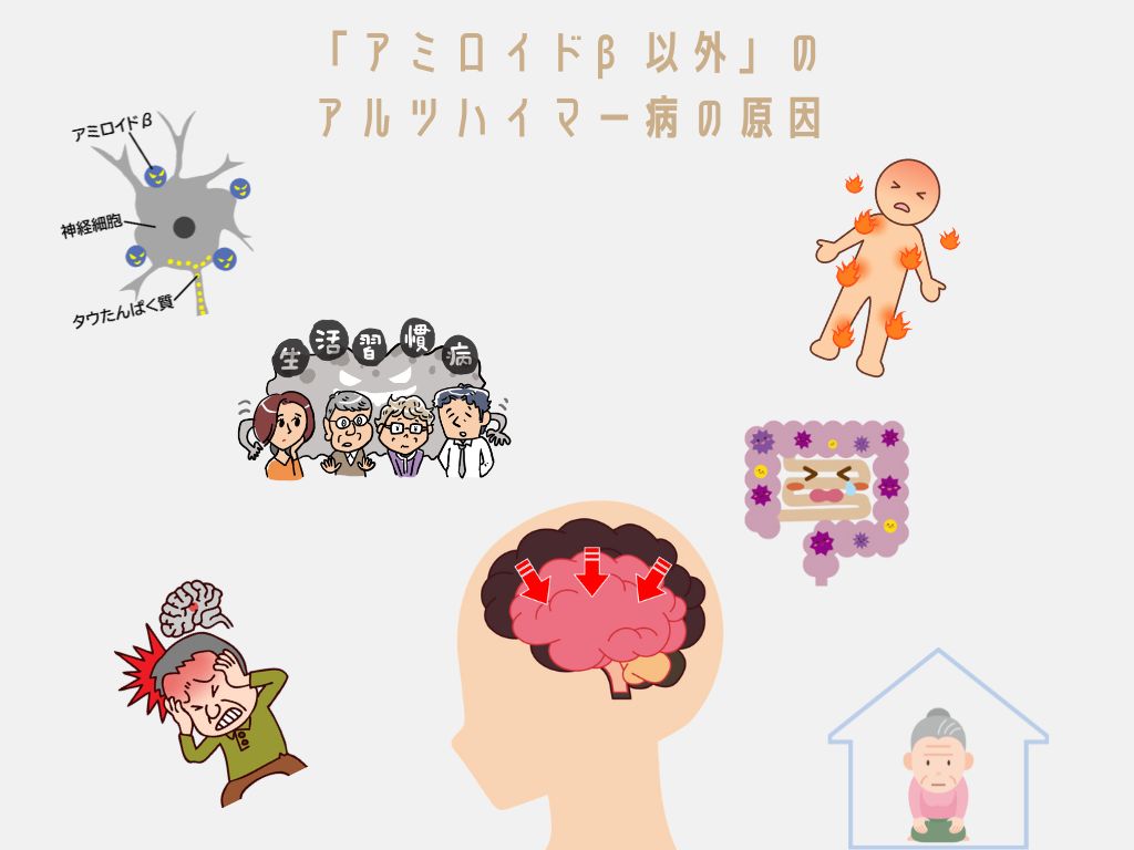 アミロイドβ以外のアルツハイマー病の原因は、タウタンパク質、脳梗塞、生活習慣病、脳内の炎症、社会的孤立、遺伝や環境要因、腸内環境
