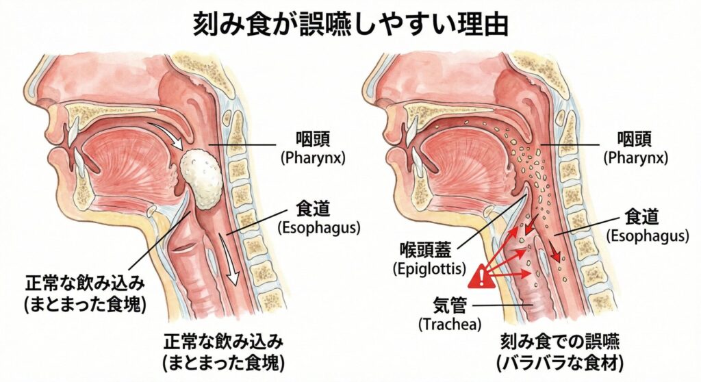なぜ「刻み食」が危険なのか？（誤嚥のメカニズム）